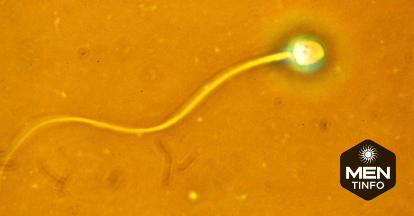 chat-luong-tinh-trung-2