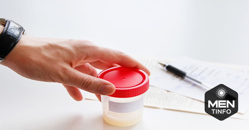 tinh-trung-dat-chat-luong-1