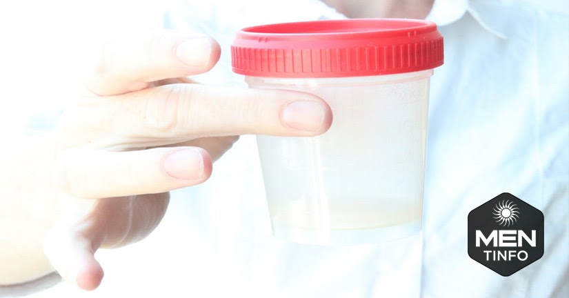 tu-kiem-tra-chat-luong-tinh-trung-2